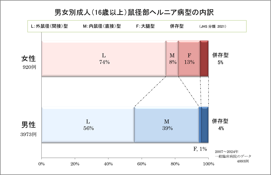 成人の鼠径ヘルニアについて